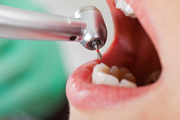 Best After-Hours Emergency Dentist in Hammond, LA